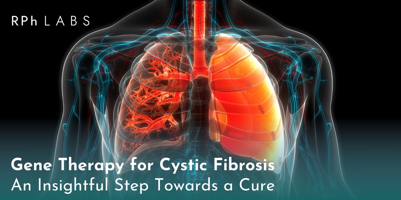 Gene therapy for cystic fibrosis