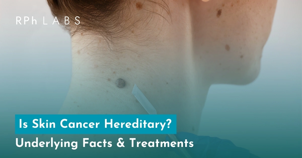 Is Skin Cancer Hereditary