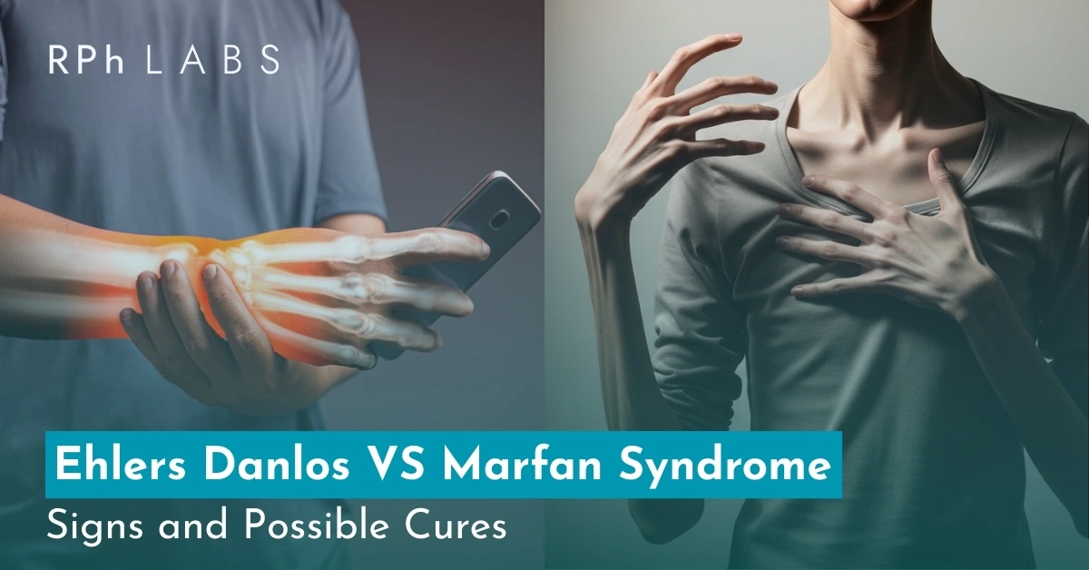 Ehlers Danlos VS Marfan Syndrome