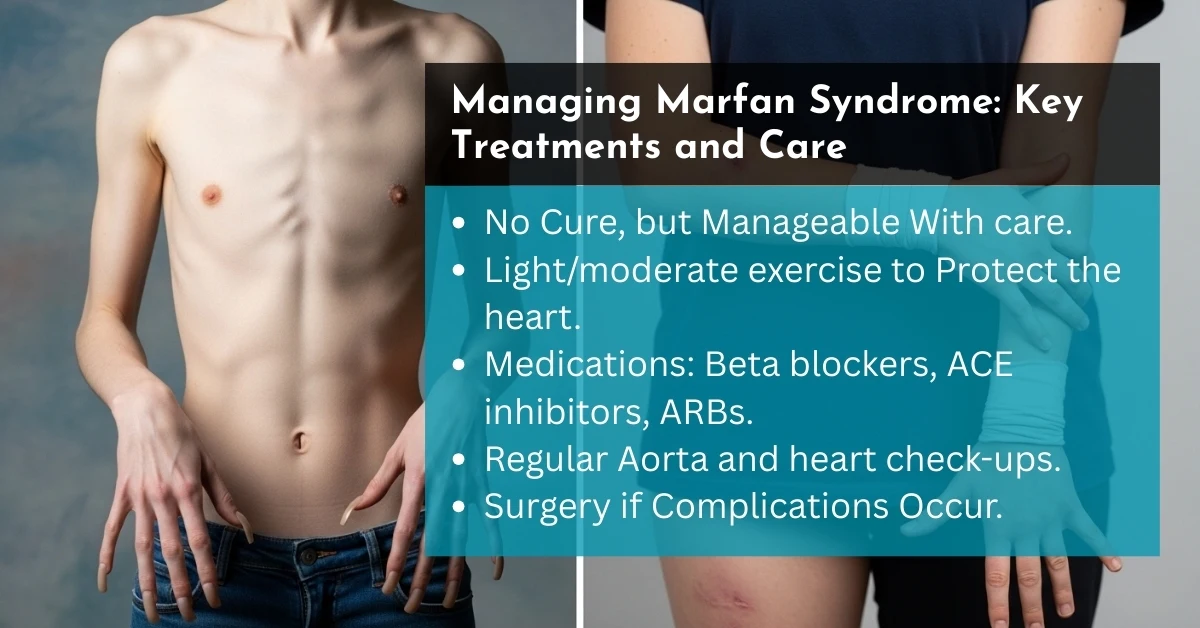 Managing Marfan Syndrome Key Treatments and Care